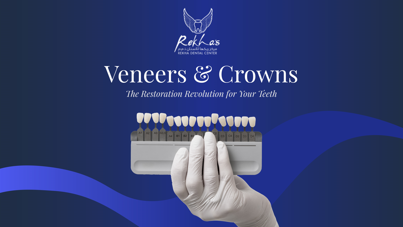 Veneers & Crowns: The Restoration Revolution for Your Teeth