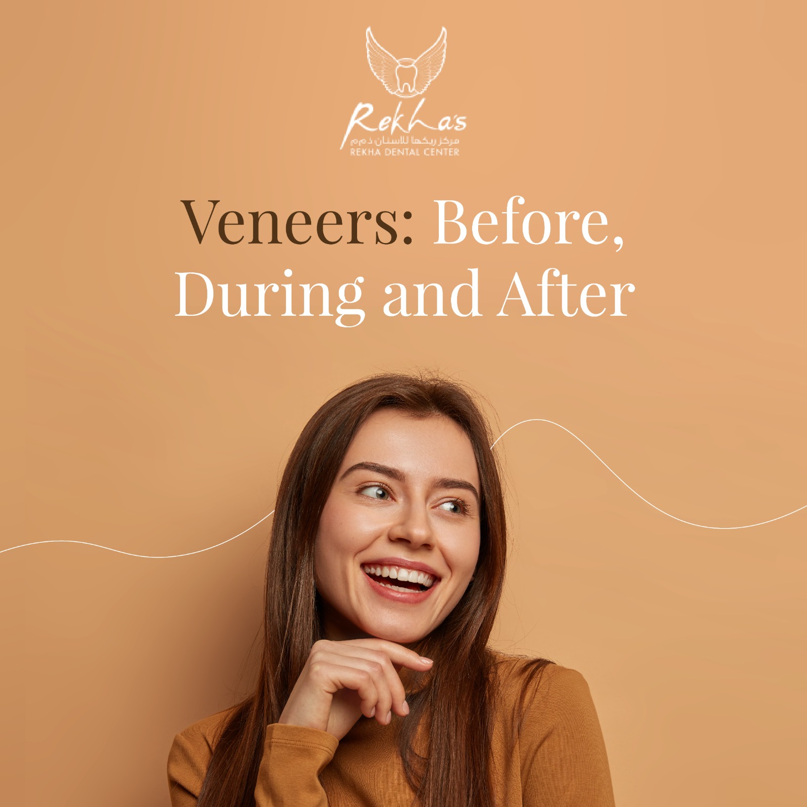 Veneers: Before, During, and After
